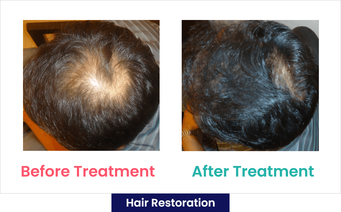 hair-treat